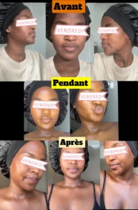 temoignage-avant-apres-02-1.webp