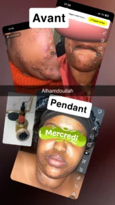 temoignage-avant-apres-27-1.webp