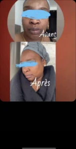 temoignage-avant-apres-28-1.webp