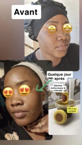 temoignage-avant-apres-44-1.webp