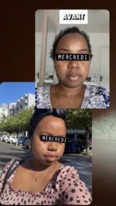 temoignage-avant-apres-47-1.webp