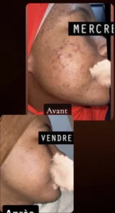 temoignage-avant-apres-48-1.webp