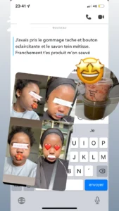 temoignage-avant-apres-49-1.webp