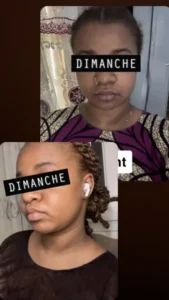 temoignage-avant-apres-50-1.webp