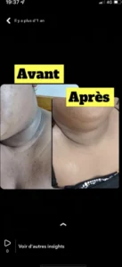 temoignage-avant-apres-51-1.webp
